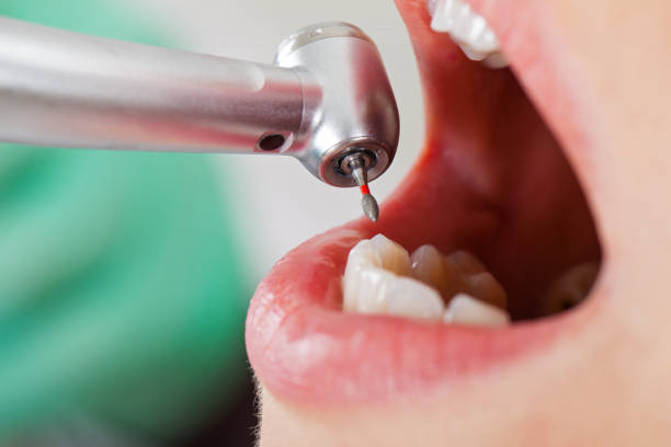Best Emergency Gum Treatment in Huntersville, NC